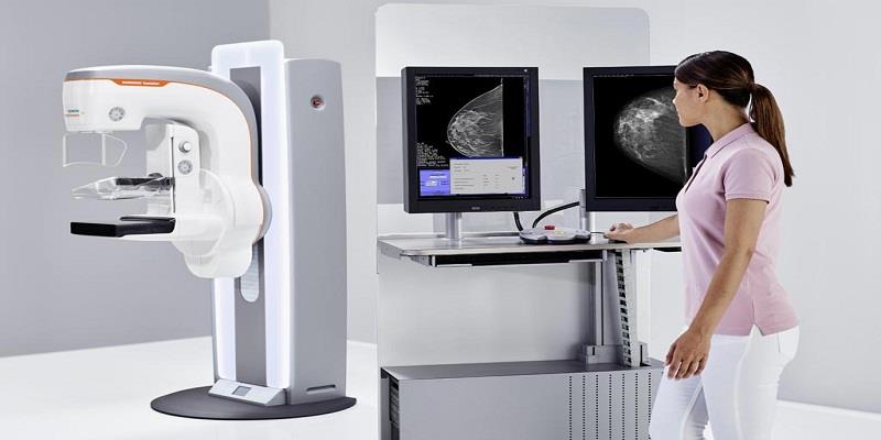 Markt für Mammographiesysteme